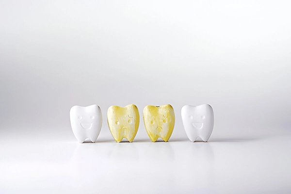 فلوئوروزیس دندانی