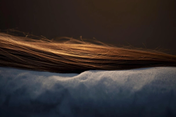 نقش استرس و خواب در رشد مو